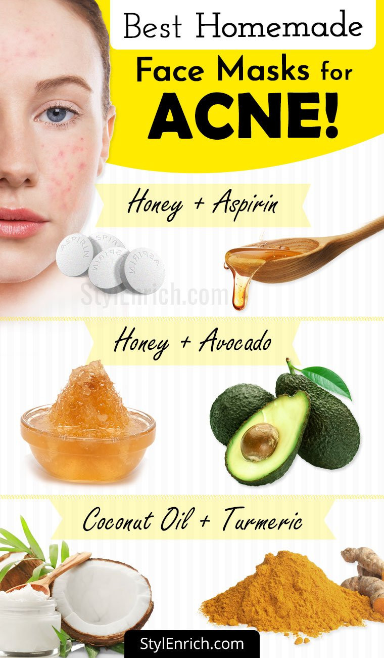 Acne DIY Face Mask
 Homemade Face Mask For Acne Treatment At Home
