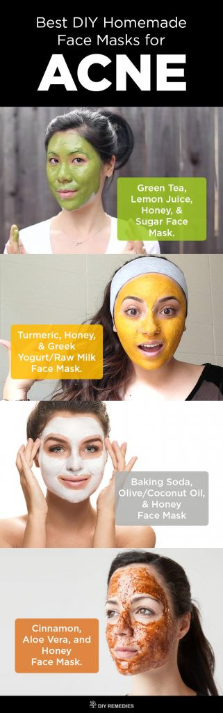 Acne DIY Face Mask
 6 Best DIY Homemade Face Masks for Acne