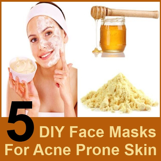 Acne DIY Mask
 5 DIY Face Masks For Acne Prone Skin
