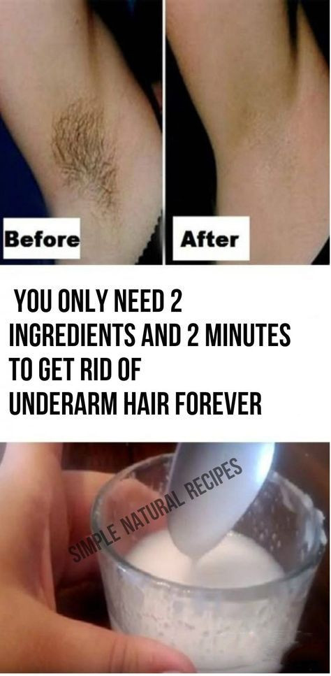 Best DIY Hair Removal
 5 best ways to remove underarms hair naturally