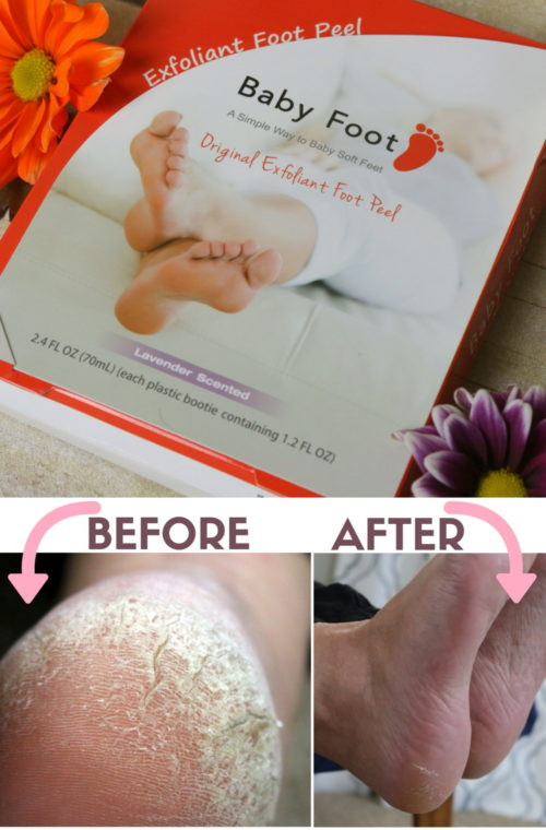 DIY Baby Feet Peel
 Does Baby Foot Really Work