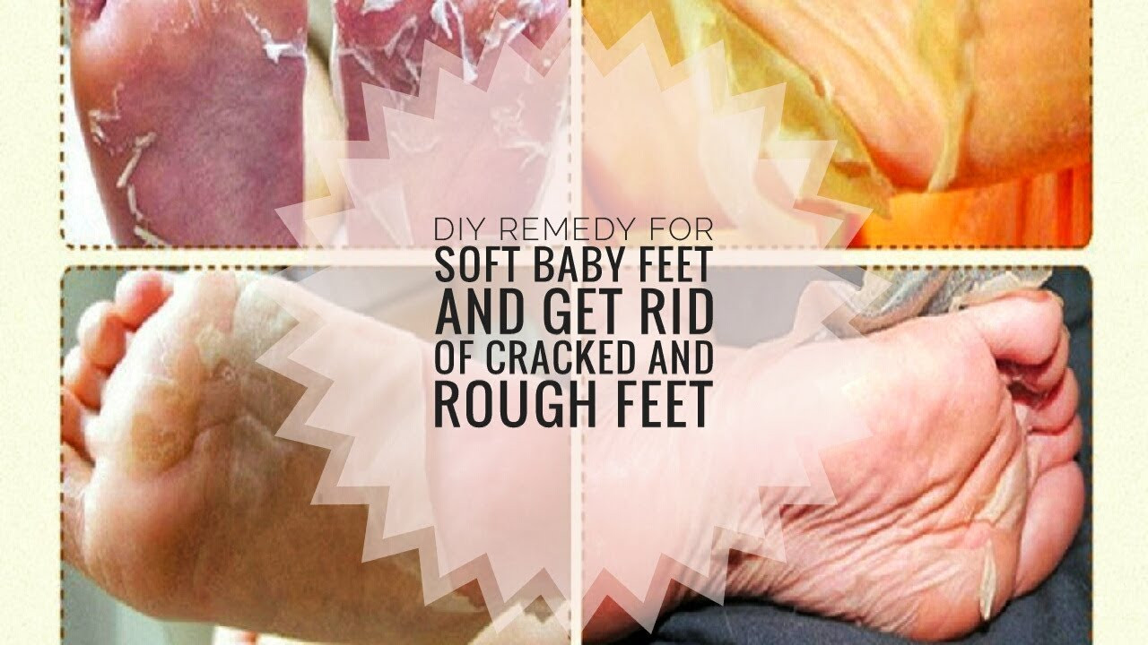 DIY Baby Feet Peel
 CHEAP DIY FOOT MASK PEEL FOR SOFT BABY FEET AND GET RID OF