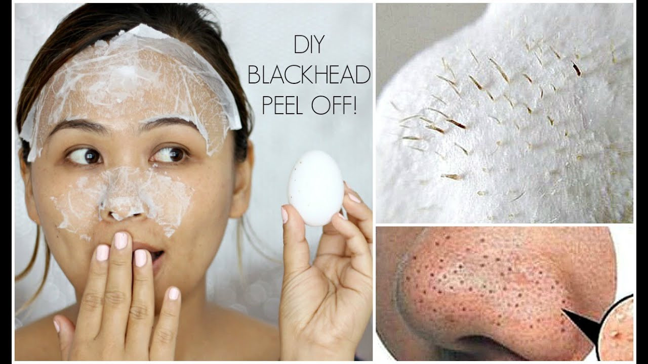 DIY Blackhead Mask
 The 23 Best Ideas for Diy Peel f Face Mask for