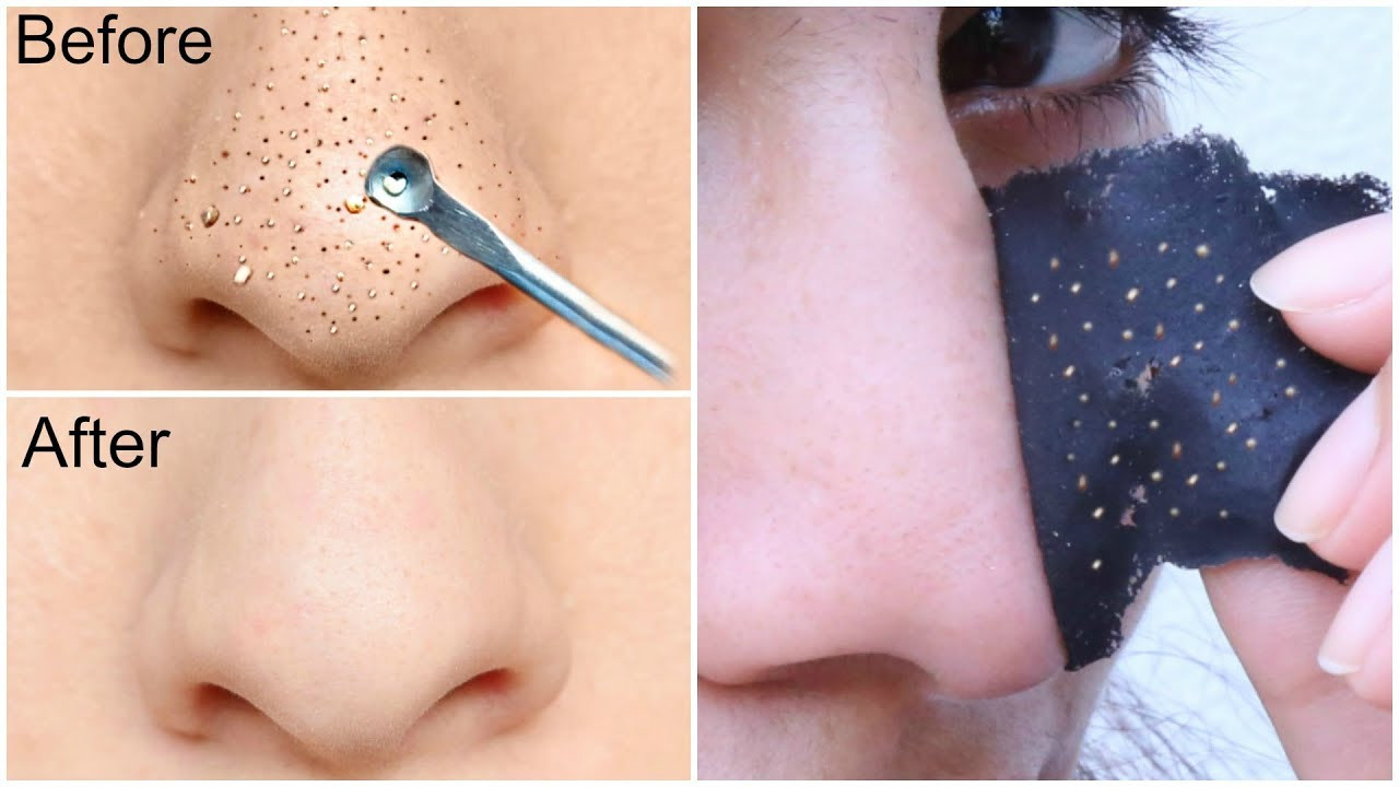 DIY Blackhead Remover Mask
 Easy DIY BLACKHEAD Remover Peel f Mask INSTANT RESULTS