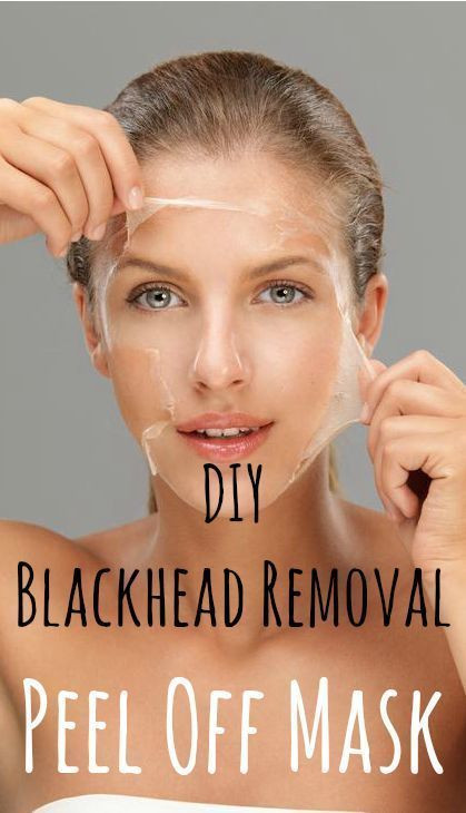 DIY Blackhead Remover Peel Off Mask
 Vingle Effective Blackhead Peel f Mask DIY Face Mask