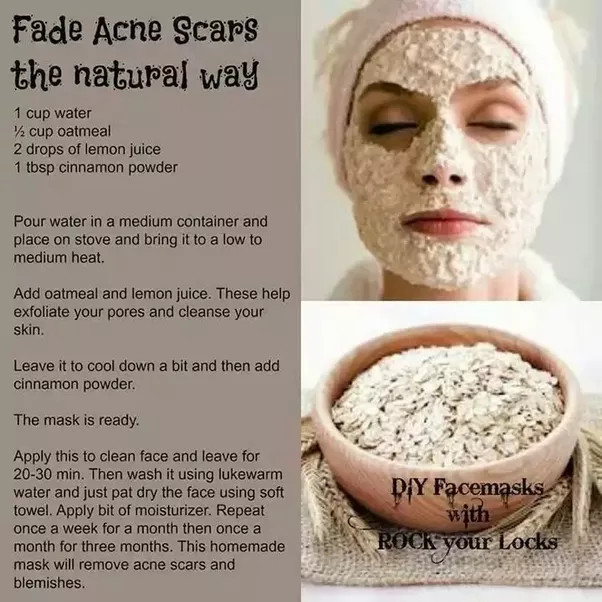 DIY Face Mask For Acne Scars
 What are the best DIY face masks for acne scars Quora
