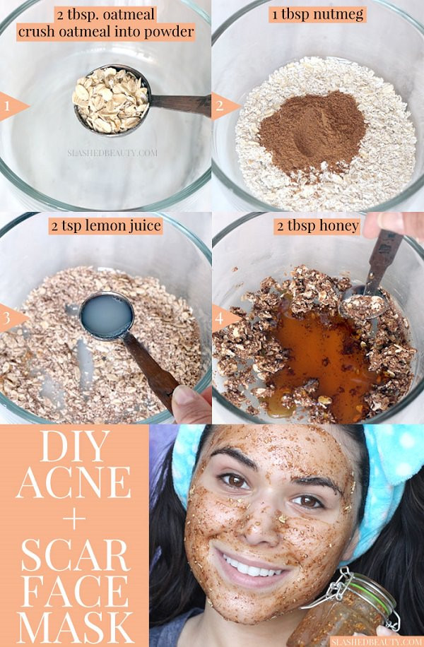 DIY Face Mask For Dry Skin And Acne
 Best DIY Face Mask for Acne & Acne Scars Honey & Nutmeg