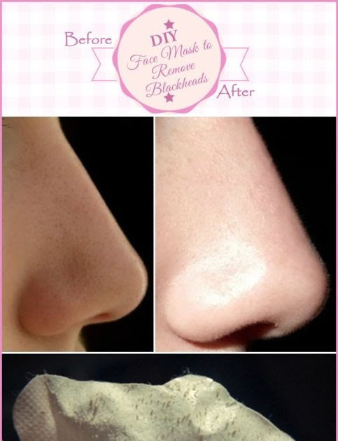 DIY Face Mask To Remove Blackheads
 PinkFashion DIY Face Mask to Remove Blackheads