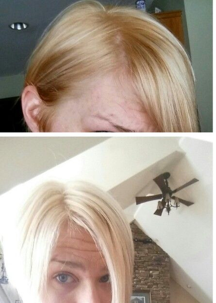 DIY Hair Color Developer
 DIY hair toner I used wella t11 and t18 mixed to her