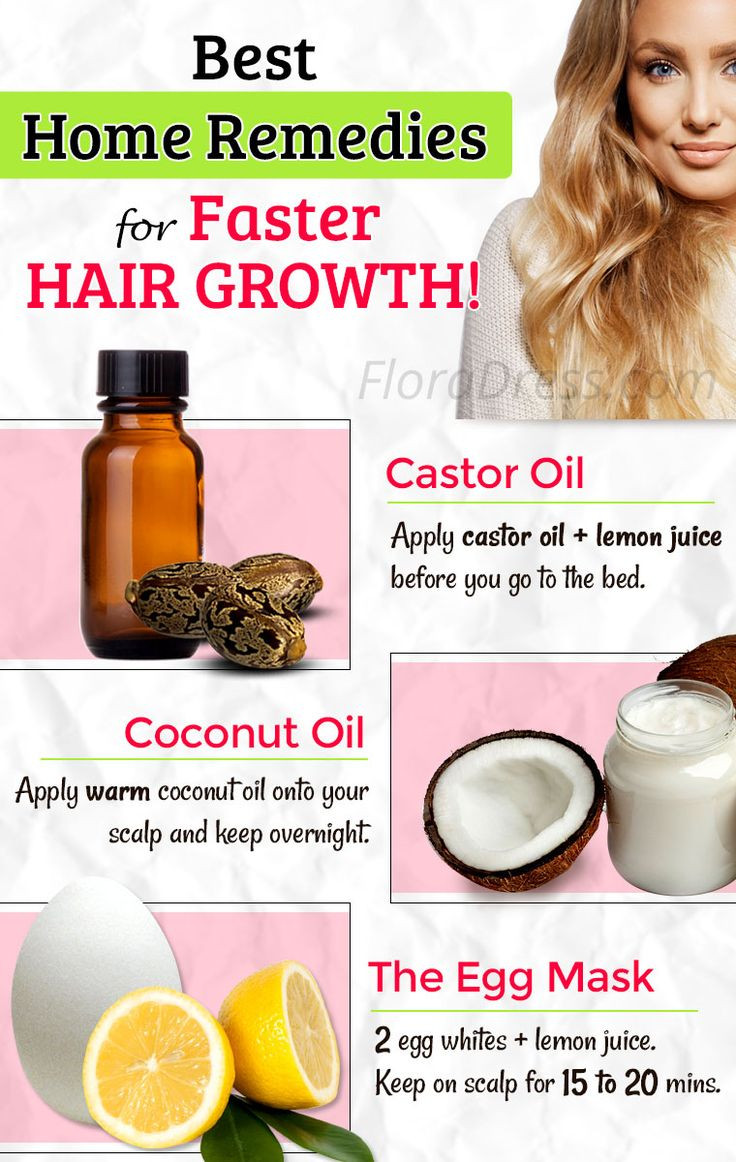 DIY Hair Loss Treatments
 Best 25 Hair growth reme s ideas on Pinterest