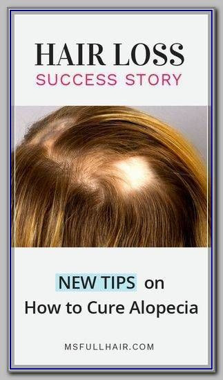 DIY Hair Loss Treatments
 Pin on Homemade Hair Loss Treatment