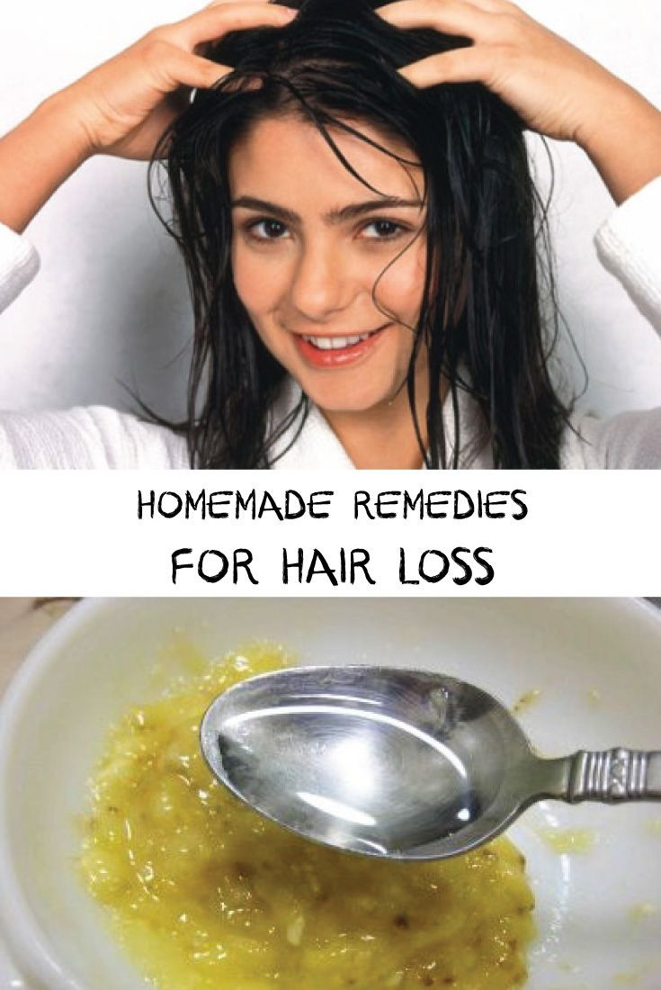DIY Hair Treatments
 281 best images about hair loss treatments on Pinterest
