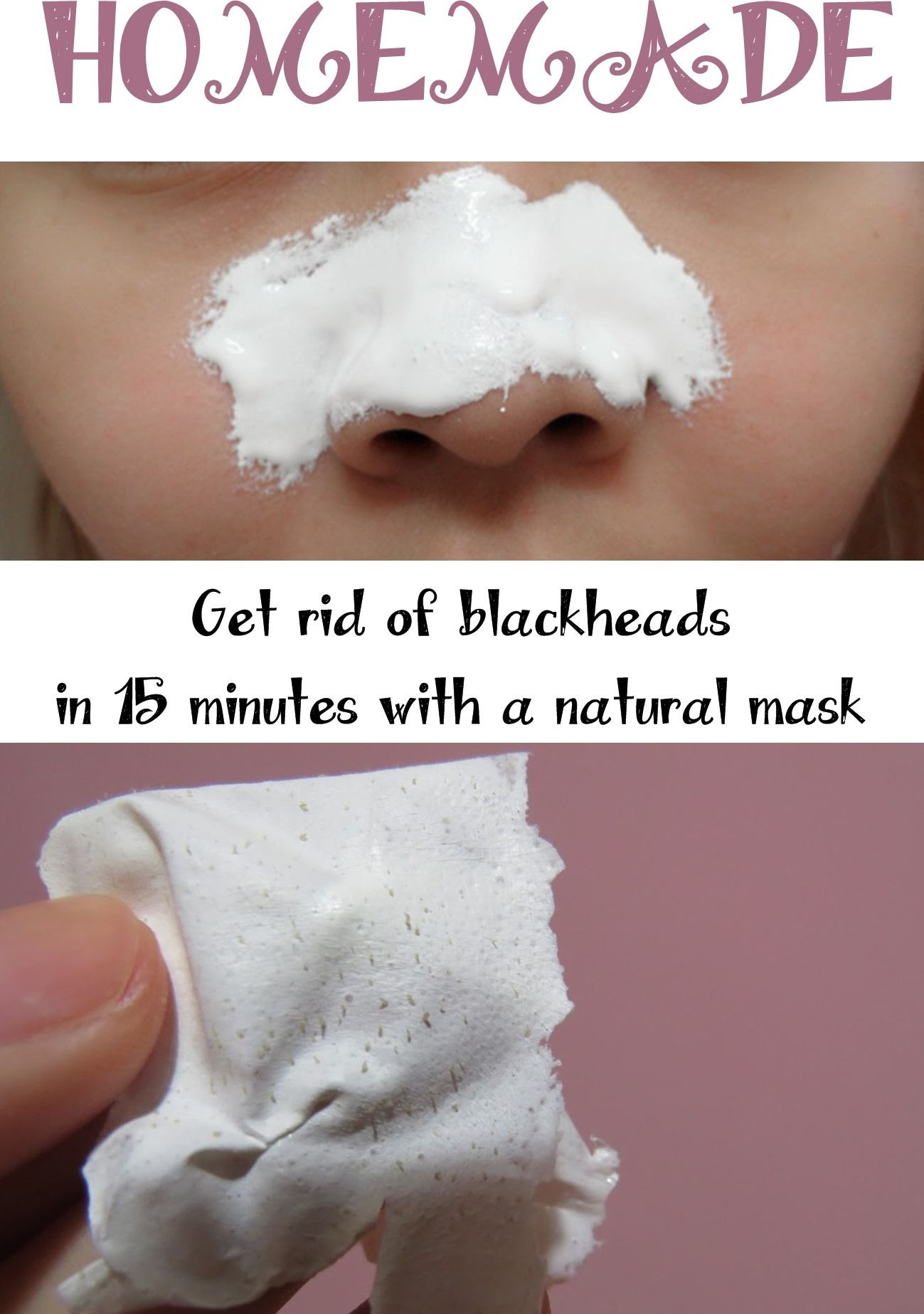 DIY Mask For Blackheads
 The Ultimate List of Healthy 53 Homemade Face Mask Recipes