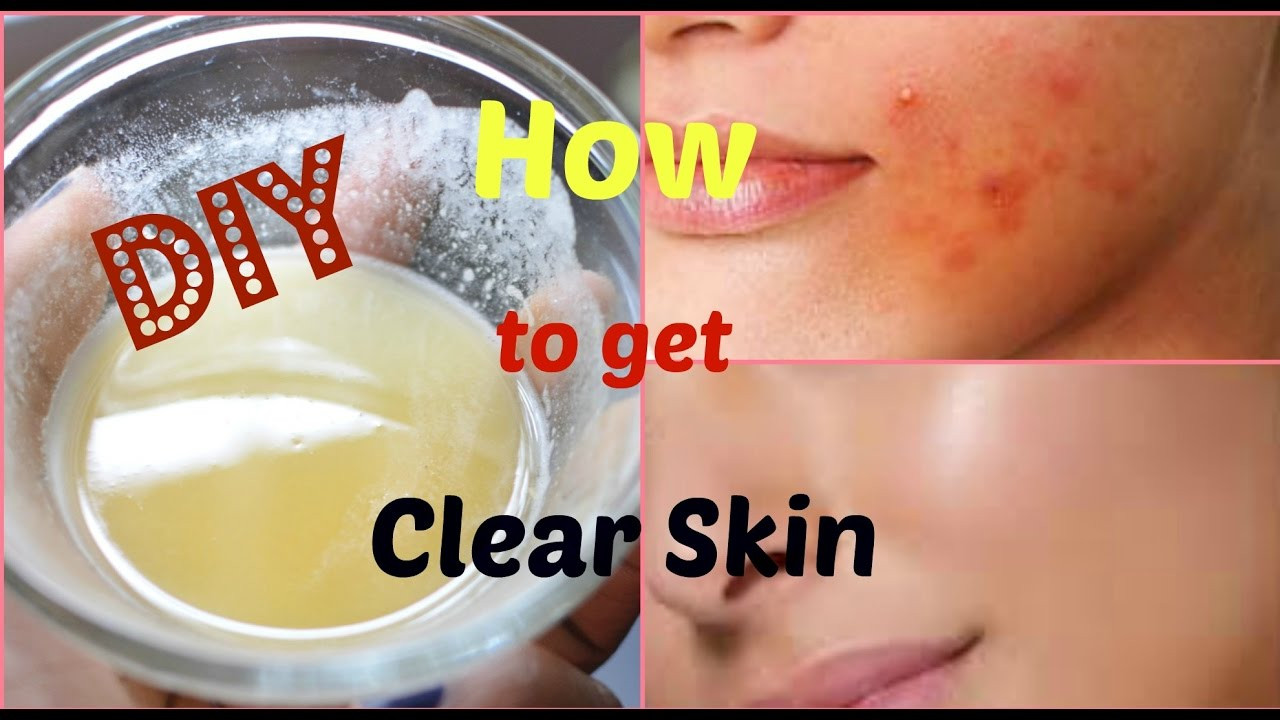 DIY Masks For Acne Scars
 DIY Face Mask to Get Rid of Acne & Acne Scars FAST