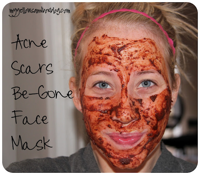 DIY Masks For Acne Scars
 Diva Tube [DIY] Homemade Acne Scars Be gone Face Mask