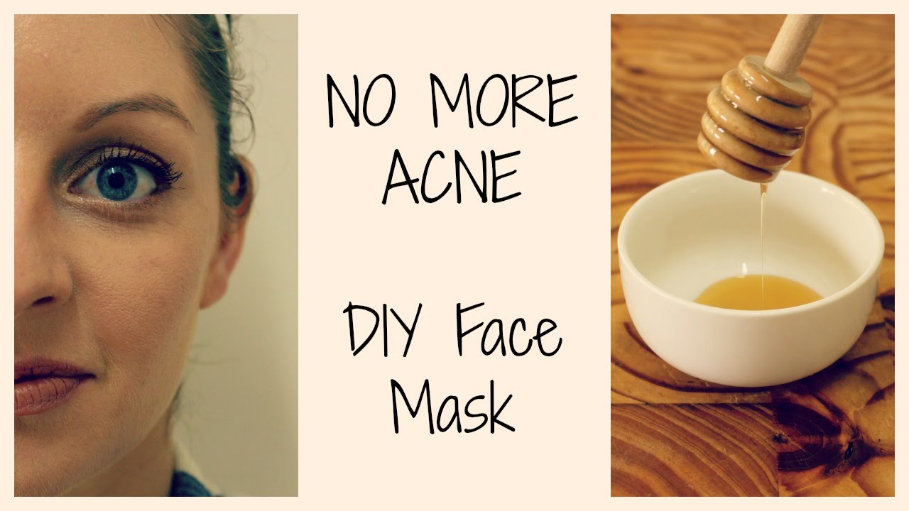 DIY Pimple Mask
 HOW TO GET CLEAR ACNE FREE SKIN