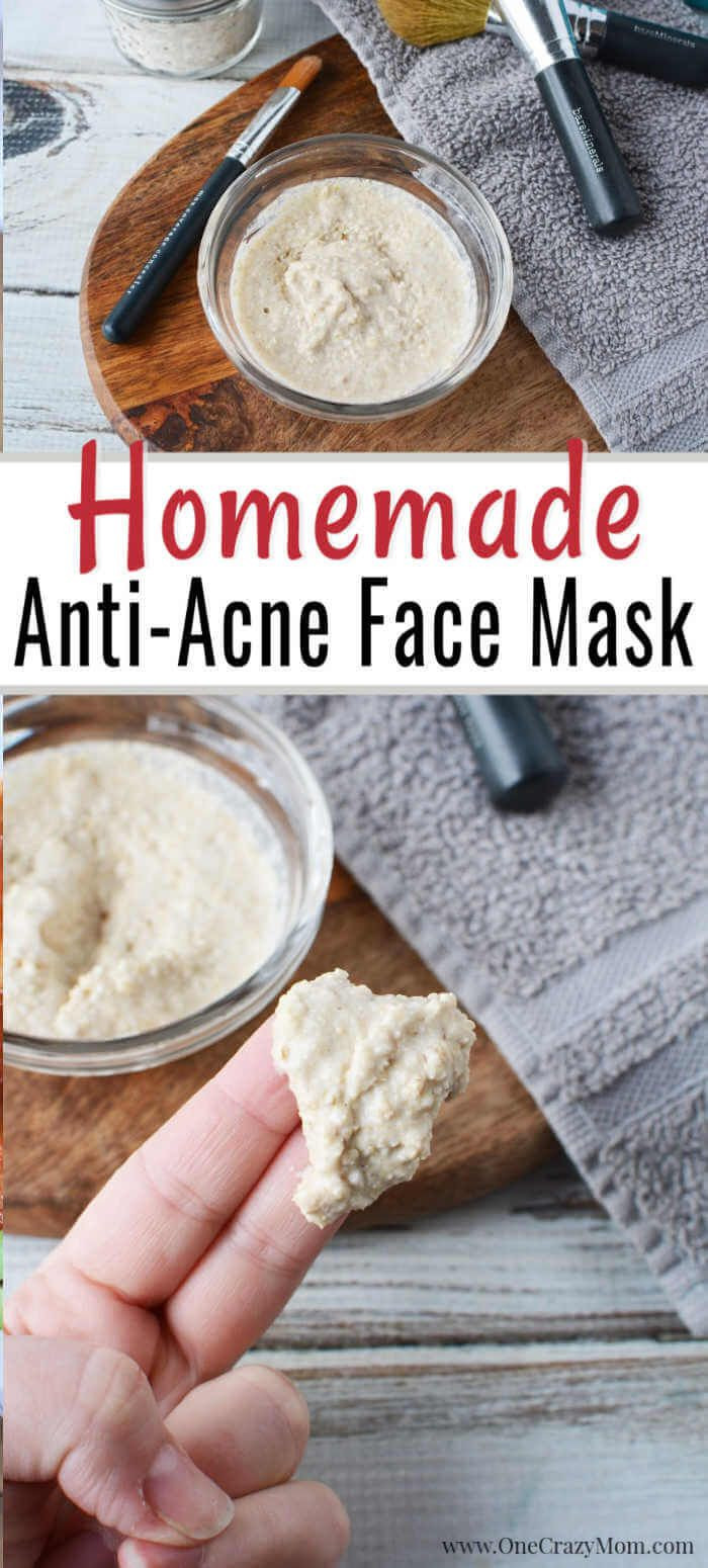 Easy DIY Face Mask For Acne
 DIY Face Mask for Acne Easy Homemade Face Mask for Acne