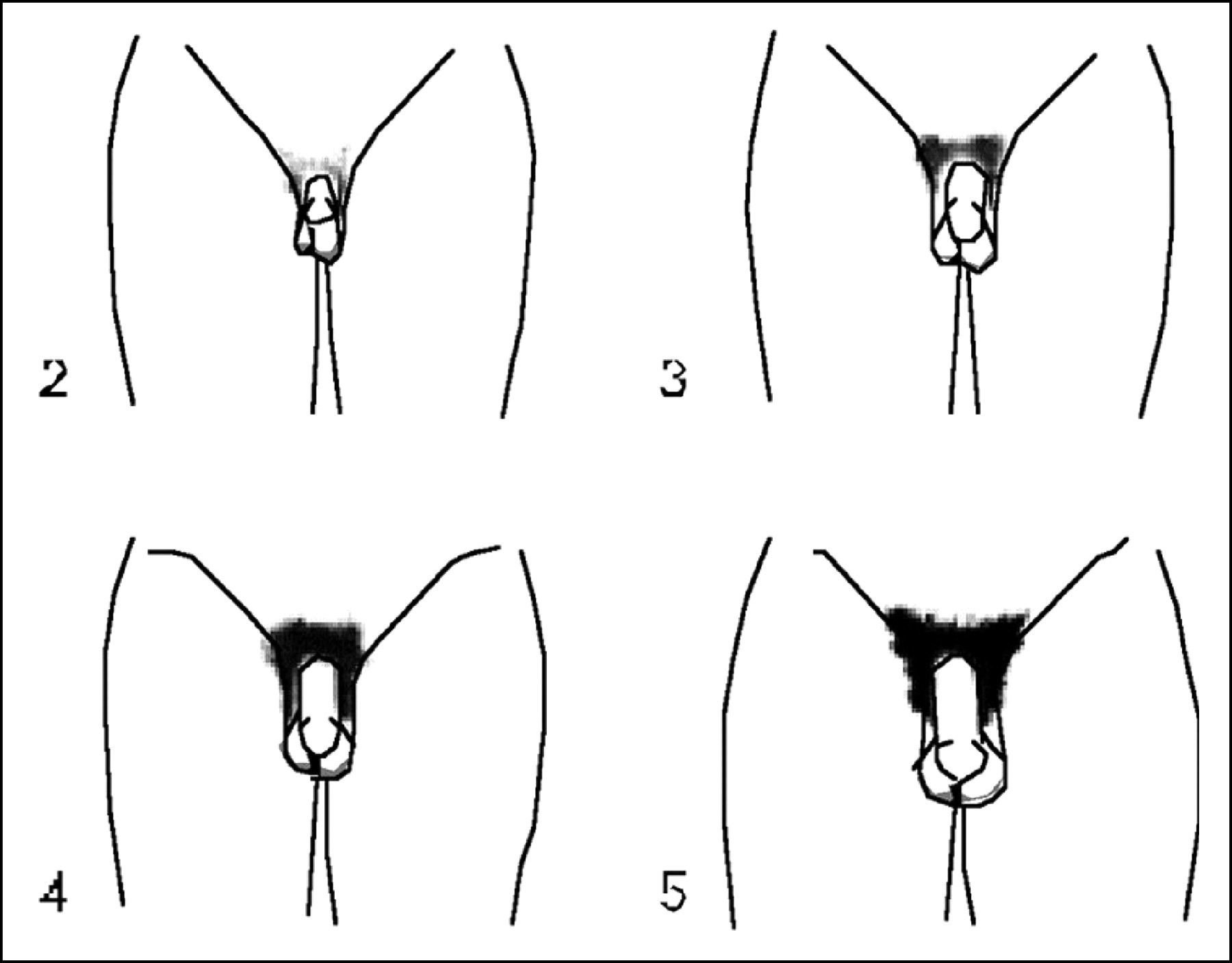 How To Cut Pubic Hair Male
 10 Exciting Parts Attending Male Pubic Hairstyles Pics