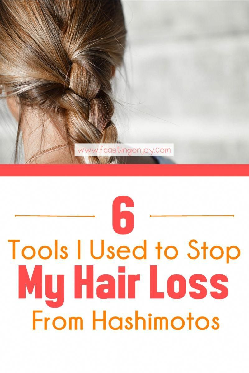 My Baby Is Losing Hair
 6 Tools I Used to Stop My Hair Loss From Hashimotos