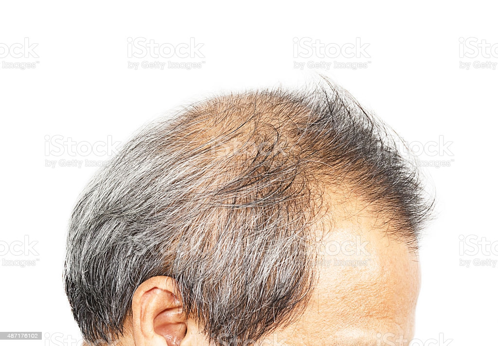 Thinning Hair In Children Symptom Checker
 Hair Loss Symptoms