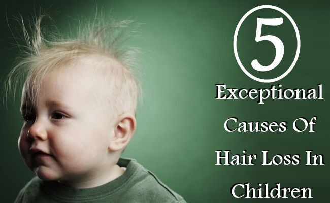 Thinning Hair In Children Symptom Checker
 Pin by Natural Lucious Locks on Thinning Hair No More