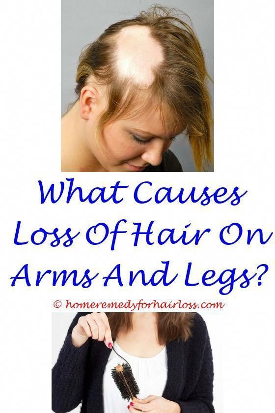 Thinning Hair In Children Symptom Checker
 Realistic revamped hair loss women products resource in
