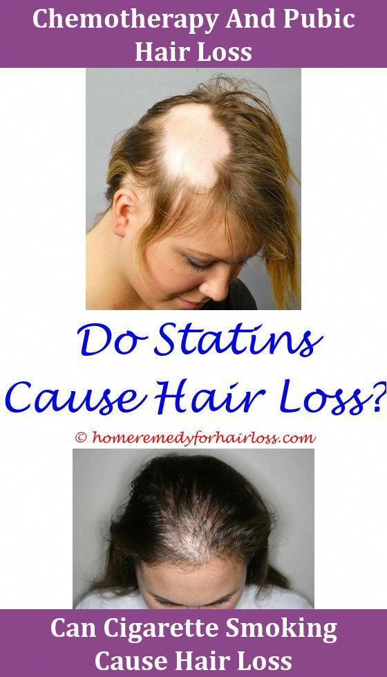 Thinning Hair In Children Symptom Checker
 Hair Loss Shampoo And Hair Loss does the crestor