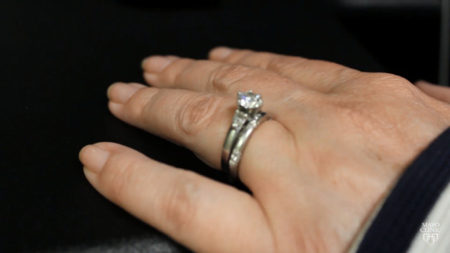 Wedding Ring Rash
 Wedding Ring Rash Video South Florida Reporter