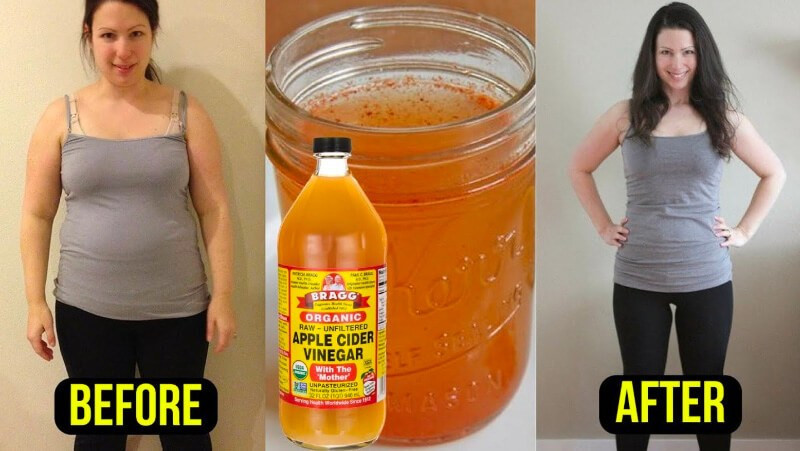 Weight Loss With Apple Cider Vinegar
 Apple Cider Vinegar Weight Loss Evidence to Lose in a week